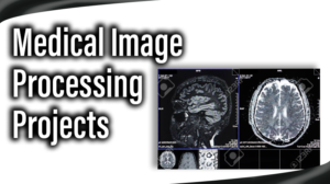 Read more about the article Medical Image Processing Projects