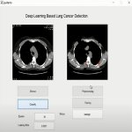 3-D Lung Tumor Segmentation Using Deep Learning -Matlab -Deep learning project