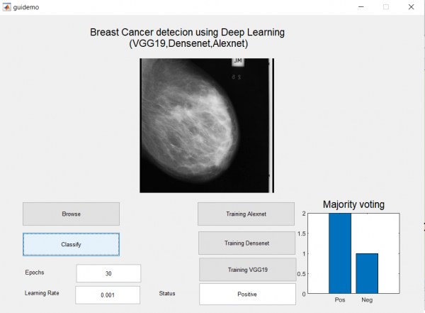 breast cancer detection using deep learning