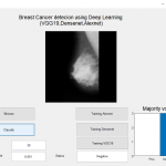 Breast Cancer Detection Based on Deep Learning