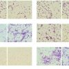 Bacteria Classification using Image Processing and Deep learning -Matlab Projects