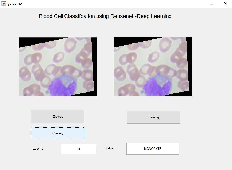 Blood Cell Classification using CNN -Deep Learning approach