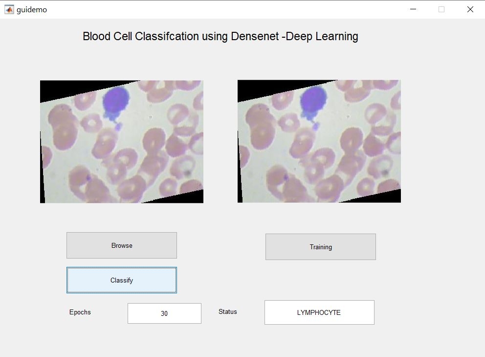 Blood Cell Classification using CNN -Deep Learning approach