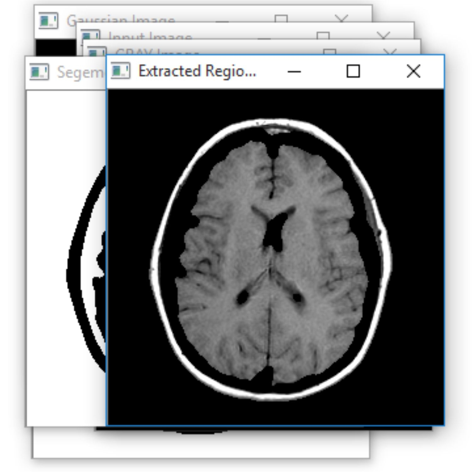 Brain Tumor Segmentation with OpenCV, Python