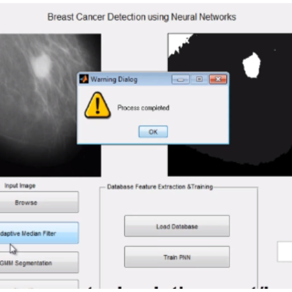 Breast Cancer Detection using Neural Networks