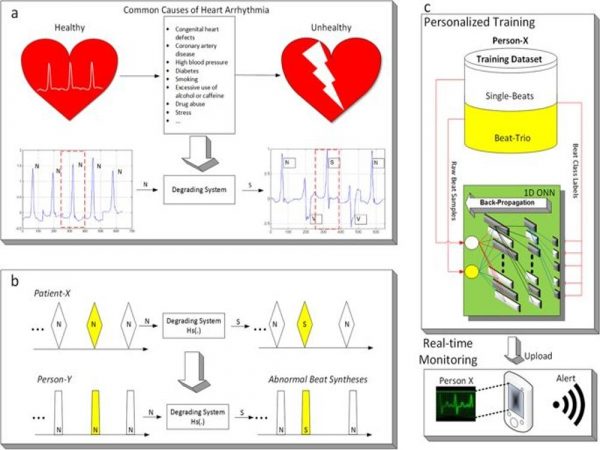 Cardiac Arrhythmia detection using Deep Learning