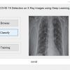 COVID-19 Detection in Xray Images using Matlab