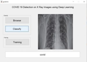 COVID-19 Detection in Xray Images using Matlab
