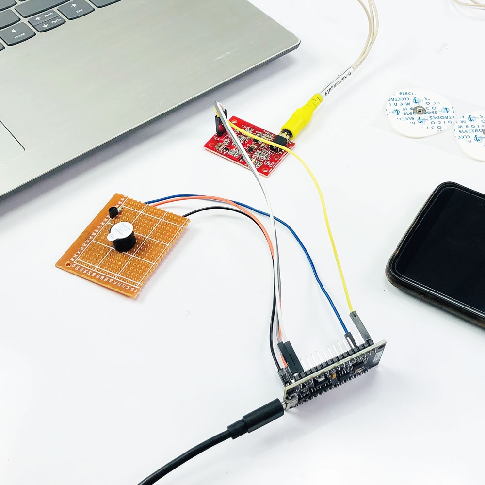 IoT Based EMG Monitoring system using Node Mcu
