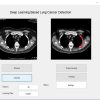 lung cancer detection using deep learning