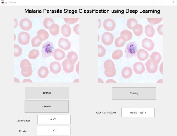 Malaria detection  Deep Learning