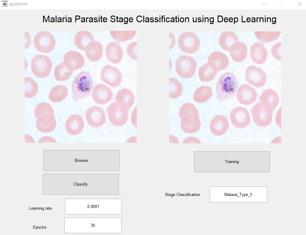 Malaria Parasite Classification using Deep Learning