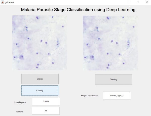 Malaria detection using Deep Learning