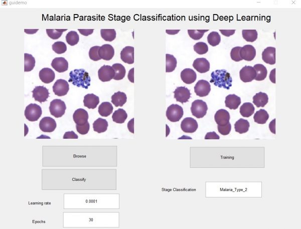 Malaria  Classification using Deep Learning