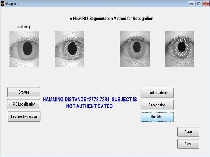 Matlab code for Iris Recognition- Image Processing Project