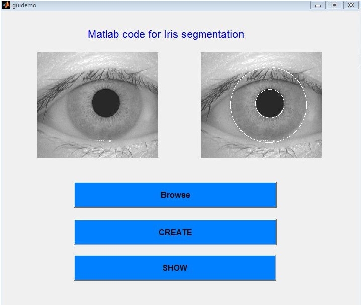 Matlab Code for Iris Segmentation