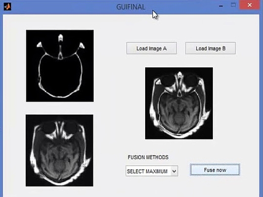 Matlab code for Neuro Fuzzy Based Image Fusion