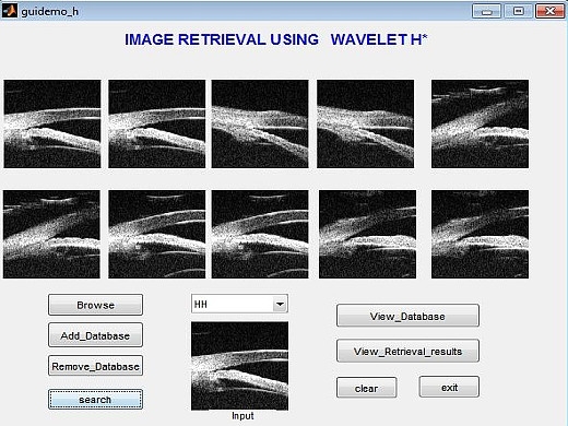 Medical Image Retrieval using Energy Efficient Wavelet