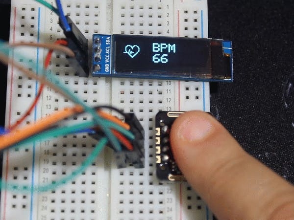 Low cost Pulse Oximeter using Arduino