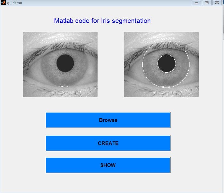 matlab code for iris segmentation