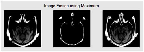 image-fusion-using-maximum
